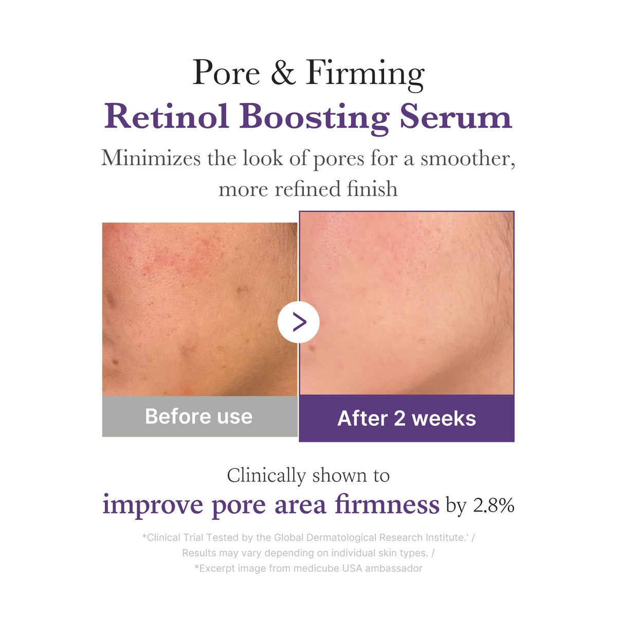 retinol-nmn-boosting-serum-s3 03_3510e7a5-5633-4a18-81ea-1389593bd517.jpg