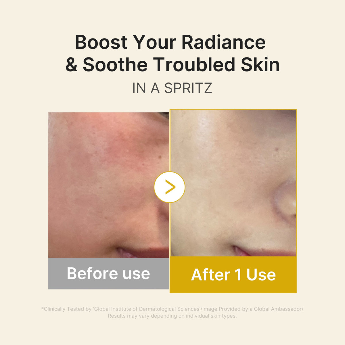 kojic-acid-turmeric-vitamin-gold-jelly-mist-serum-n3 03_dc9cd19e-4e57-49d3-9b66-c7762e8a63f1.jpg