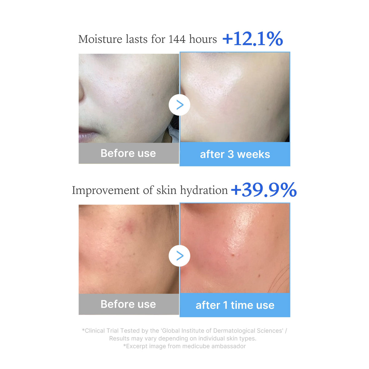 hyaluronic-multi-peptide-pdrn-serum-y8 03_ec681914-6c31-4d68-bb03-b1773e8f8015.jpg