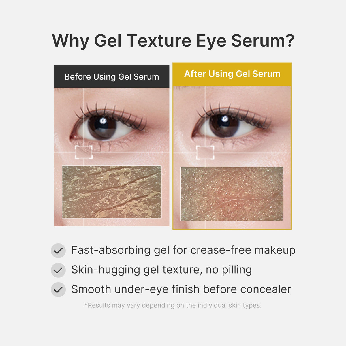kojic-acid-tumeric-eye-gel-serum-w6 04_0487ef36-49f4-4294-8049-bb55118b05fe.jpg